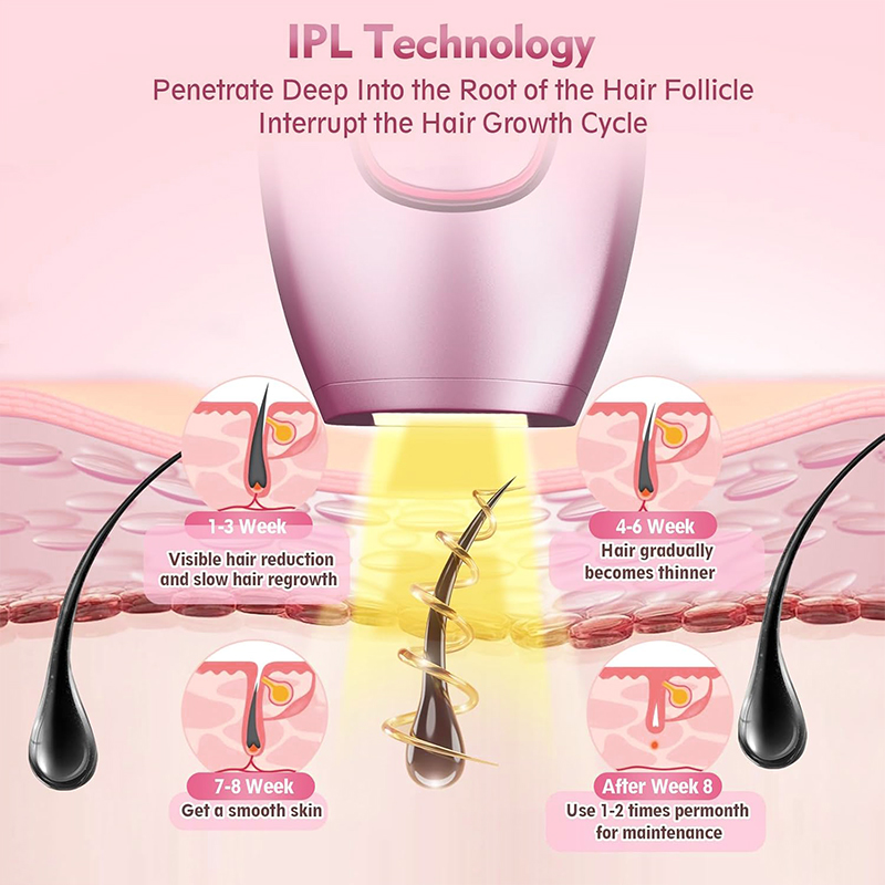 IPL เลเซอร์กําจัดขนตัดผม Strai - Industrial Laser Cutter บทวิจารณ์และราคา
